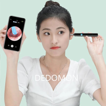 ClearView™ Smart Ear Cleaner – HD Camera Ear Wax Removal Tool with Real-Time Visual Inspection
